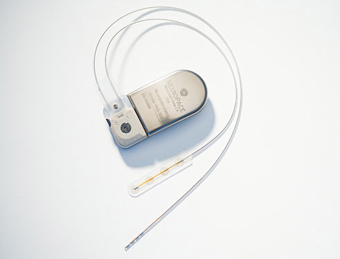 NeuroPace stimulator