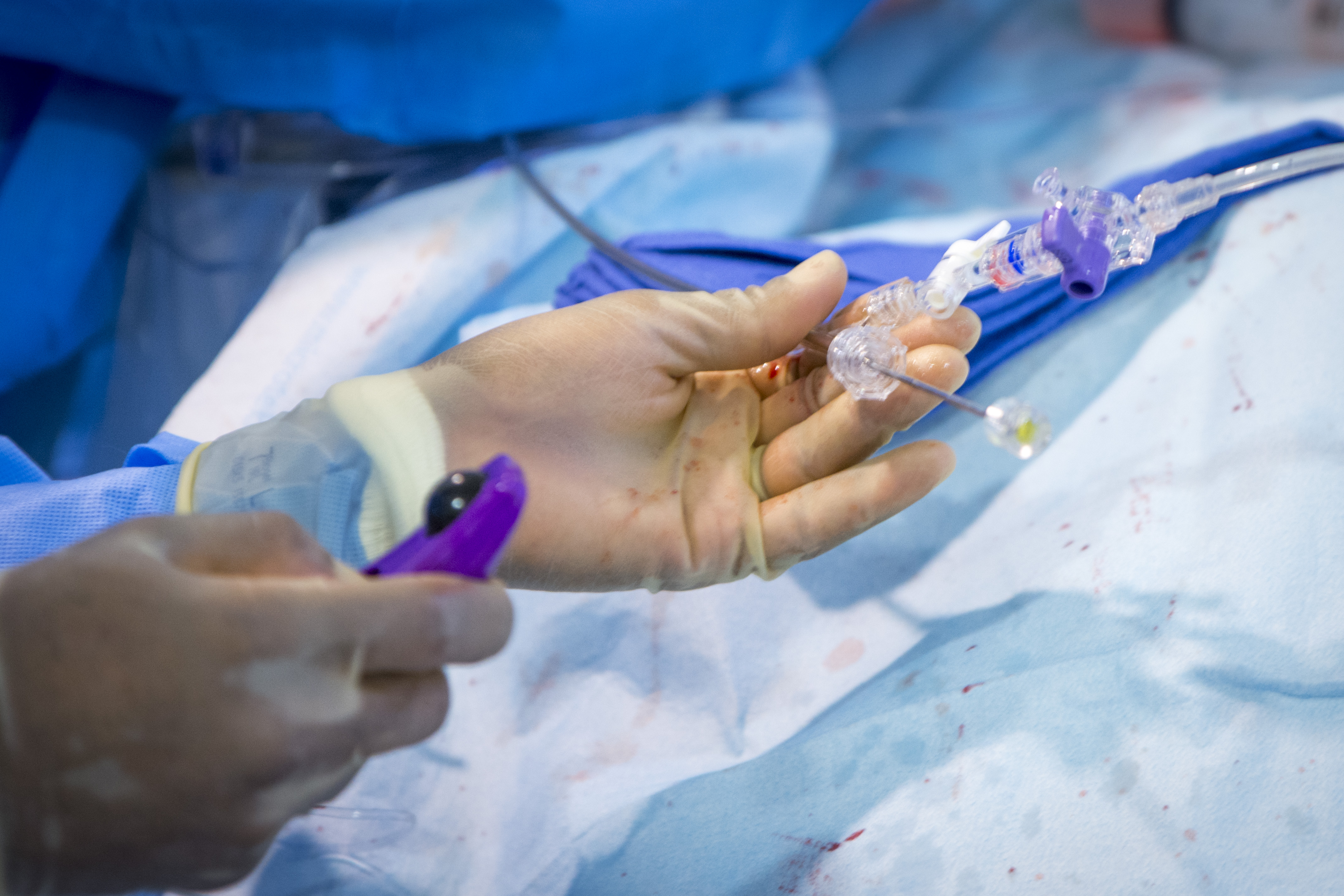 watchman operation
