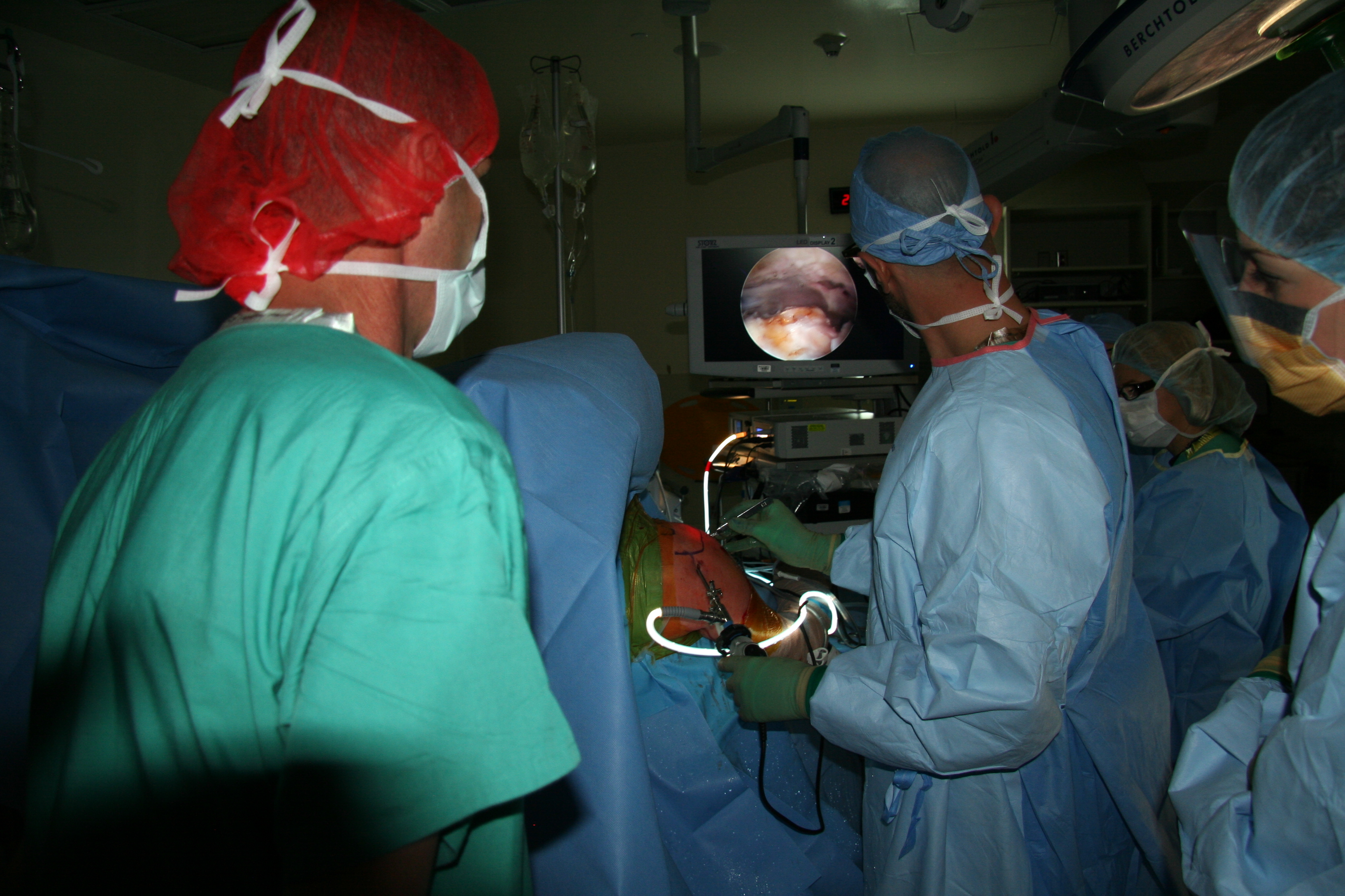 Bravman Shoulder Scope 