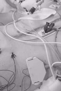 A photo of a patient being prepped for a cardiac procedure.