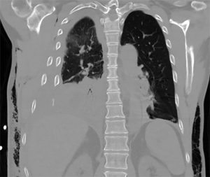 An image from a CT scan
