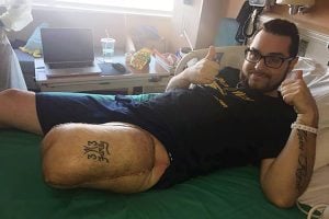 A patient lays in bed after his leg surgery.