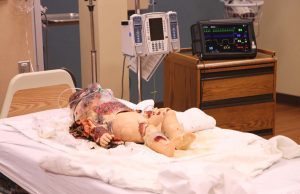 This is a photo of a child-age, high-fidelity simulator. The simulators are used have realistic abilities. Burned clothing and theater makeup help portray a realistic situation that the nurse may encounter.