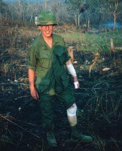 A young J.D. Hill with bandages on his arm and leg.