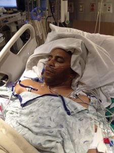 Jeff Bramstedt is shown right after surgery. Thousands of people each year need a live liver transplant.