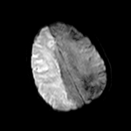 MRI of Amy's brain.