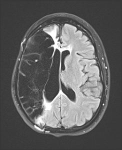 MRI of Amy's brain.