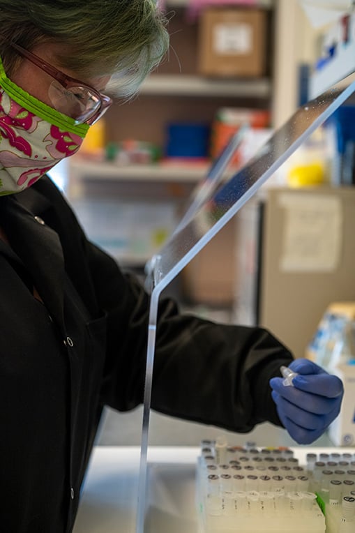 Researchers at the Anschutz Medical Campus are creating a homegrown antibody test.