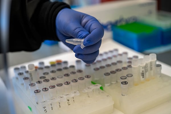antibody testing for COVID-19 in Colorado