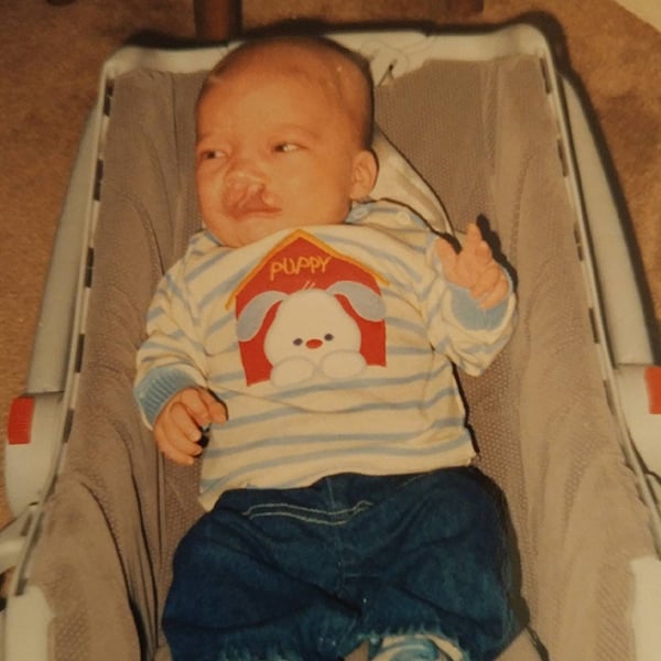 Matt Johnston as a baby. He was born with a cleft palate and a heart defect that later prompted him to take up running.