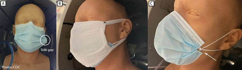 Masks the CDC researchers tested, including A, unknotted medical procedure mask; B, double mask (cloth mask covering medical procedure mask); and C, knotted/tucked medical procedure mask. Photo courtesy of CDC.