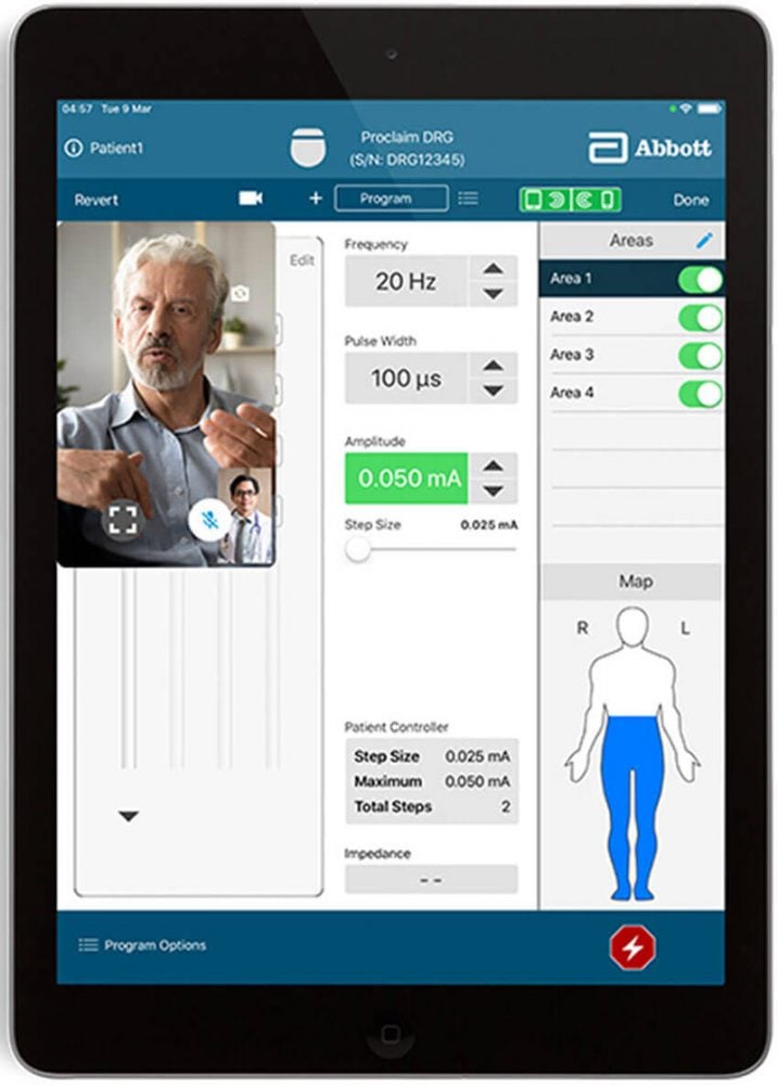Abbott received FDA approval for its DBS telehealth and remote-adjustment technology in March. Here’s the physician’s perspective. Image courtesy of Abbott.
