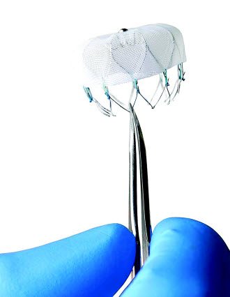 The WATCHMAN Device | WATCHMAN Heart Procedure | UCHealth